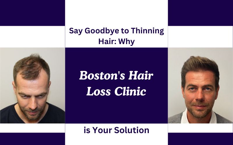 Say-Goodbye-to-Thinning-Hair-Why-Bostons-Hair-Loss-Clinic-is-Your-Solution